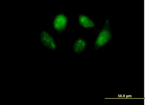 Anti-SMU1 antibody produced in mouse purified immunoglobulin, buffered aqueous solution