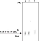 Anti-Calbindin-D-28K (KD-15) antibody produced in rabbit affinity isolated antibody, buffered aqueous solution