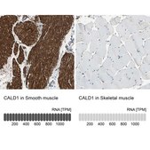 Anti-CALD1 antibody produced in rabbit Ab1, Prestige Antibodies&#174; Powered by Atlas Antibodies, affinity isolated antibody, buffered aqueous glycerol solution