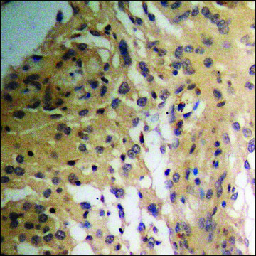 Anti-phospho-p70 S6 Kinase (pSer418) antibody produced in rabbit affinity isolated antibody