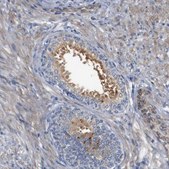 Anti-CYB561 antibody produced in rabbit Prestige Antibodies&#174; Powered by Atlas Antibodies, affinity isolated antibody, buffered aqueous glycerol solution