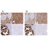 Anti-SORD antibody produced in rabbit Prestige Antibodies&#174; Powered by Atlas Antibodies, affinity isolated antibody, buffered aqueous glycerol solution