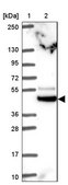 Anti-TRIM44 antibody produced in rabbit Prestige Antibodies&#174; Powered by Atlas Antibodies, affinity isolated antibody, buffered aqueous glycerol solution