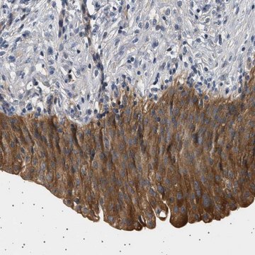 Anti-PLPP6 antibody produced in rabbit Prestige Antibodies&#174; Powered by Atlas Antibodies, affinity isolated antibody, buffered aqueous glycerol solution