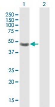 Anti-CRELD1 antibody produced in rabbit purified immunoglobulin