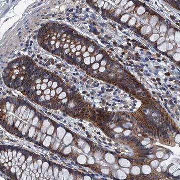 Anti-DDX49 antibody produced in rabbit Prestige Antibodies&#174; Powered by Atlas Antibodies, affinity isolated antibody, buffered aqueous glycerol solution