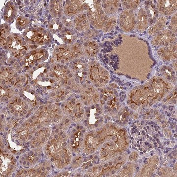 Anti-ATP10A antibody produced in rabbit Prestige Antibodies&#174; Powered by Atlas Antibodies, affinity isolated antibody, buffered aqueous glycerol solution