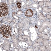 Monoclonal Anti-LAMA5 antibody produced in mouse Prestige Antibodies&#174; Powered by Atlas Antibodies, clone CL3118, purified immunoglobulin, buffered aqueous glycerol solution