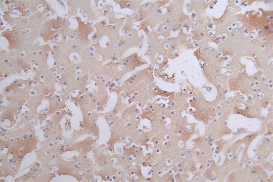 Anti-phospho-MAPT (S404) antibody, clone 11H10, Rabbit Monoclonal recombinant, expressed in HEK293F cells