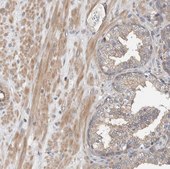 Anti-MPRIP antibody produced in rabbit Prestige Antibodies&#174; Powered by Atlas Antibodies, affinity isolated antibody, buffered aqueous glycerol solution, Ab2