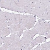 Anti-PLA2G1B antibody produced in rabbit Prestige Antibodies&#174; Powered by Atlas Antibodies, affinity isolated antibody, buffered aqueous glycerol solution