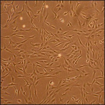 Human Chondrocytes - Osteoarthritis: HC-OA, adult