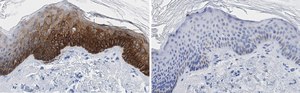 Anti-Cytokeratin-14 Antibody, clone 1D15 ZooMAb&#174; Rabbit Monoclonal recombinant, expressed in HEK 293 cells