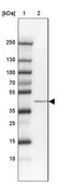 Anti-SCCPDH antibody produced in rabbit Prestige Antibodies&#174; Powered by Atlas Antibodies, affinity isolated antibody, buffered aqueous glycerol solution