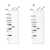 Anti-SERPINB1 antibody produced in rabbit Prestige Antibodies&#174; Powered by Atlas Antibodies, affinity isolated antibody, buffered aqueous glycerol solution