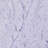 Anti-LZTFL1 antibody produced in rabbit Prestige Antibodies&#174; Powered by Atlas Antibodies, affinity isolated antibody, buffered aqueous glycerol solution