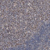 Anti-UQCRC1 antibody produced in rabbit Ab2, Prestige Antibodies&#174; Powered by Atlas Antibodies, affinity isolated antibody, buffered aqueous glycerol solution