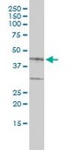 Monoclonal Anti-BGN antibody produced in mouse clone 4E1-1G7, purified immunoglobulin, buffered aqueous solution