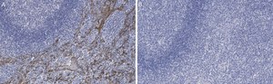 Anti-Cytokeratin 5/6 Antibody, clone D5/16 B4 ZooMAb&#174; Mouse Monoclonal recombinant, expressed in HEK 293 cells