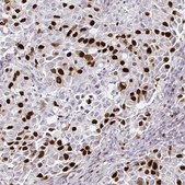 Monoclonal Anti-ANLN antibody produced in mouse Prestige Antibodies&#174; Powered by Atlas Antibodies, clone CL0301, purified immunoglobulin, buffered aqueous glycerol solution