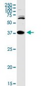 Anti-TREX1 antibody produced in rabbit purified immunoglobulin, buffered aqueous solution