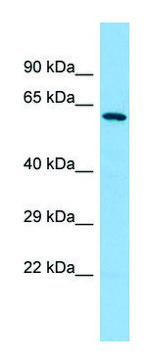Anti-YTHDF2 (C-terminal) antibody produced in rabbit affinity isolated antibody