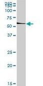 Anti-ETS1 antibody produced in rabbit purified immunoglobulin, buffered aqueous solution