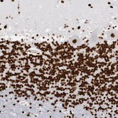 Anti-MECP2 antibody produced in rabbit Ab2, Prestige Antibodies&#174; Powered by Atlas Antibodies, affinity isolated antibody, buffered aqueous glycerol solution
