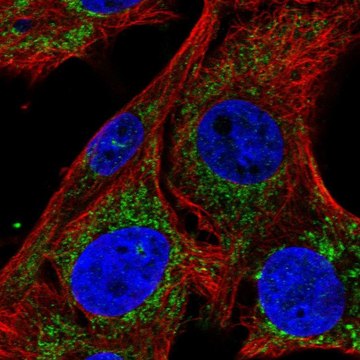 Anti-SLC25A34 antibody produced in rabbit Prestige Antibodies&#174; Powered by Atlas Antibodies, affinity isolated antibody