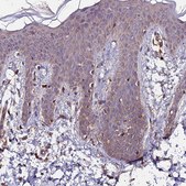 Anti-ZNF598 antibody produced in rabbit Prestige Antibodies&#174; Powered by Atlas Antibodies, affinity isolated antibody, buffered aqueous glycerol solution