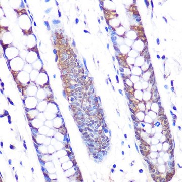 Anti-SKP2 antibody produced in rabbit