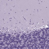 Anti-FOXI1 antibody produced in rabbit Prestige Antibodies&#174; Powered by Atlas Antibodies, affinity isolated antibody, buffered aqueous glycerol solution
