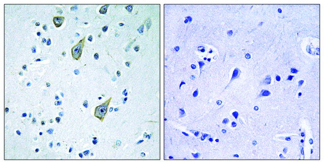 Anti-FZD6 antibody produced in rabbit affinity isolated antibody