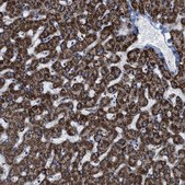 Anti-ALDH1B1 antibody produced in rabbit Prestige Antibodies&#174; Powered by Atlas Antibodies, affinity isolated antibody, buffered aqueous glycerol solution
