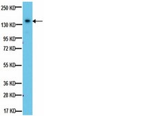 Anti-IGF-IR Antibody, &#946;-subunit, clone 1-2 clone 1-2, from mouse, purified by affinity chromatography
