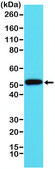 Anti-CK-14 (Cytokeratin-14) antibody, Rabbit monoclonal recombinant, expressed in HEK 293 cells, clone RM328, purified immunoglobulin