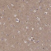 Anti-PEA15 Prestige Antibodies&#174; Powered by Atlas Antibodies, affinity isolated antibody