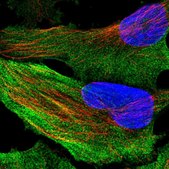 Anti-ACACA antibody produced in rabbit Prestige Antibodies&#174; Powered by Atlas Antibodies, affinity isolated antibody