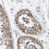 Anti-PANX1 antibody produced in rabbit Prestige Antibodies&#174; Powered by Atlas Antibodies, affinity isolated antibody, buffered aqueous glycerol solution