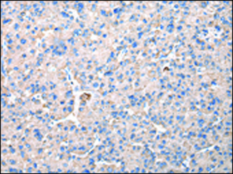 Anti-CHMP3 affinity isolated antibody