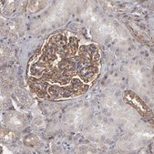 Anti-ITGB5 antibody produced in rabbit Prestige Antibodies&#174; Powered by Atlas Antibodies, affinity isolated antibody, buffered aqueous glycerol solution