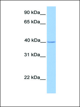 Anti-ZNF385D (AB1) antibody produced in rabbit affinity isolated antibody