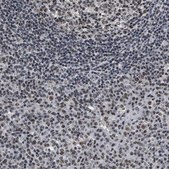 Anti-RRP1B antibody produced in rabbit Prestige Antibodies&#174; Powered by Atlas Antibodies, affinity isolated antibody, buffered aqueous glycerol solution, Ab2