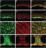 Anti-Neurofilament L Antibody serum, Chemicon&#174;