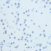 Anti-CDK9 antibody produced in rabbit