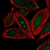 Anti-POLE3 antibody produced in rabbit Prestige Antibodies&#174; Powered by Atlas Antibodies, affinity isolated antibody, buffered aqueous glycerol solution