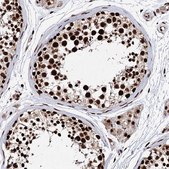 Anti-MATR3 antibody produced in rabbit Prestige Antibodies&#174; Powered by Atlas Antibodies, affinity isolated antibody, buffered aqueous glycerol solution
