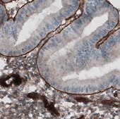 Monoclonal Anti-LAMC1 antibody produced in mouse Prestige Antibodies&#174; Powered by Atlas Antibodies, clone CL3201, purified immunoglobulin, buffered aqueous glycerol solution