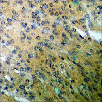 Anti-phospho-BID (pSer78) antibody produced in rabbit affinity isolated antibody