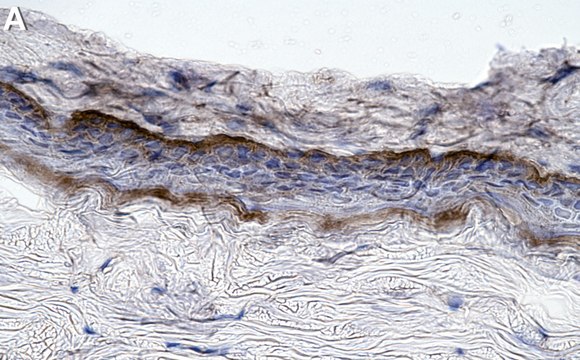 Anti-Collagen Type VII Antibody, clone NP32 ZooMAb&#174; Mouse Monoclonal recombinant, expressed in HEK 293 cells